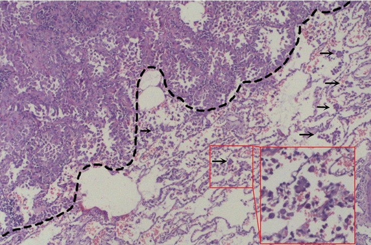 Observation of histological sections of bronchial tissue.
